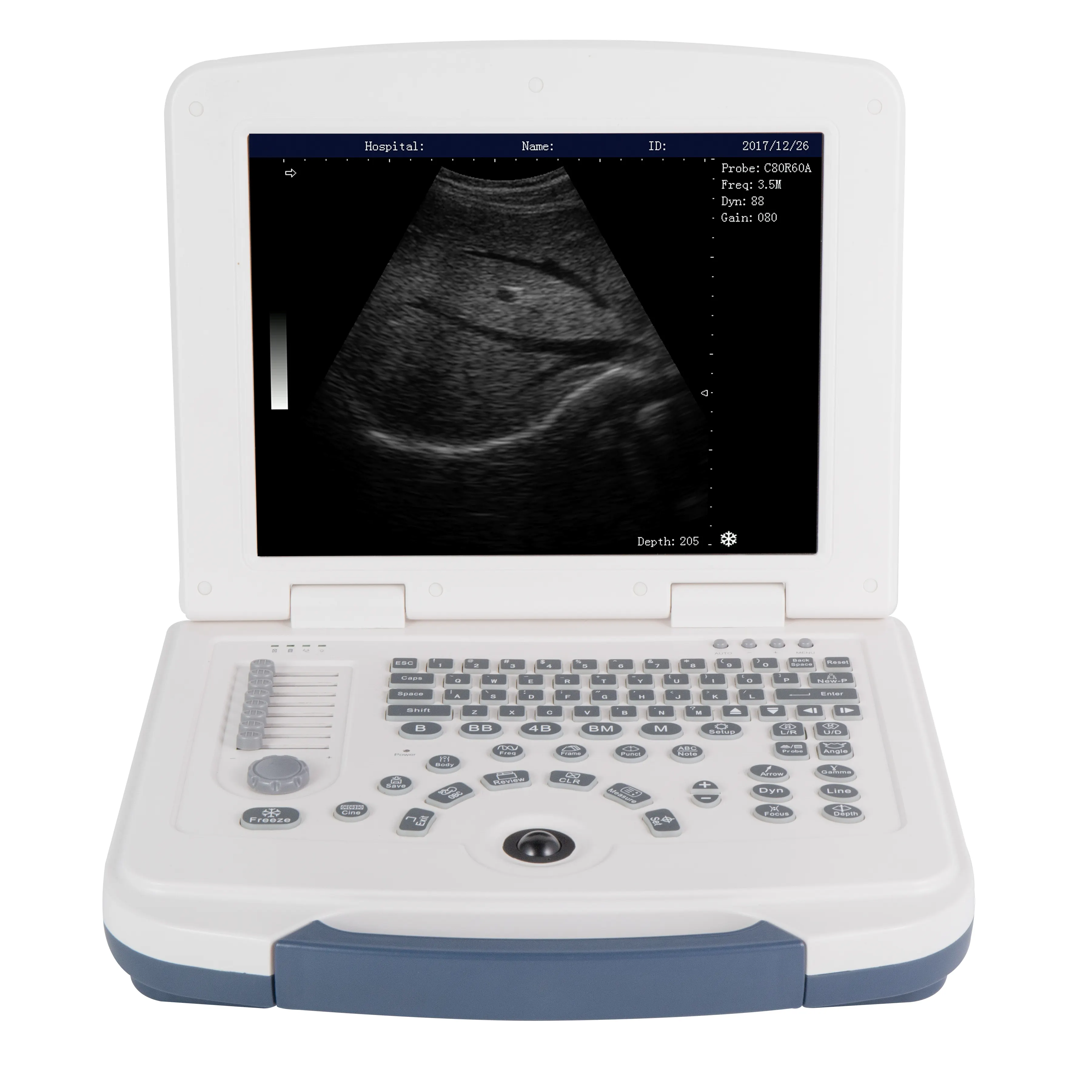 Dawei Made China Ecografo Portatil Humano Cheap 12.1inch LED Display Electric Ultrasound Scanner CE Certified Hospital Use