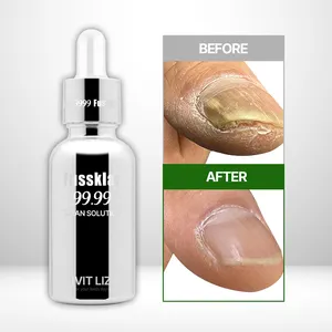 Fussklar Deep Action Nail Serum to Repair Fungal Infected Nails and Strengthen Weak Thin Damaged Nails for Healthy Growth