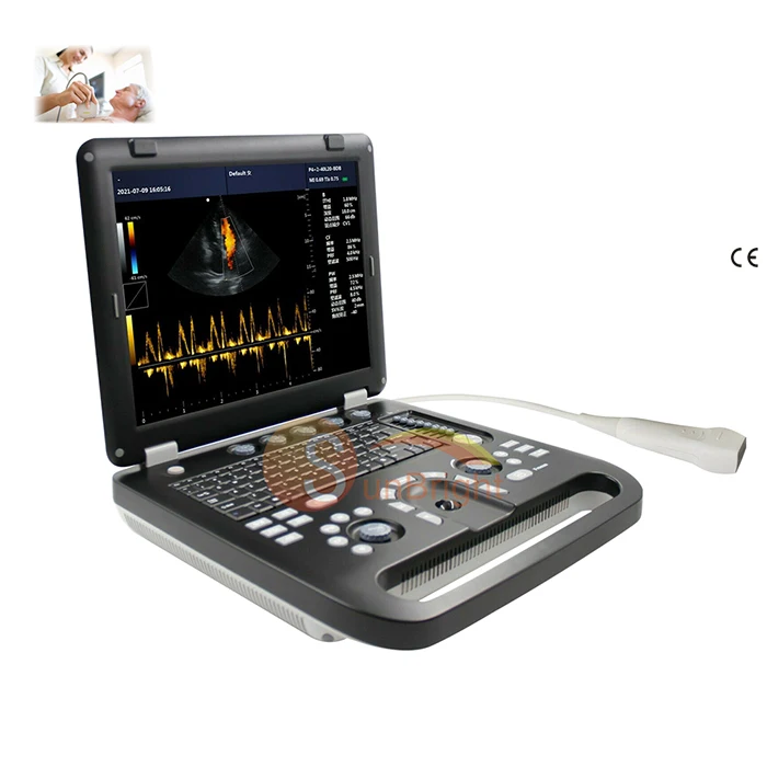 Portable Ultrasonic Laptop 3D Color Doppler Ultrasound Scanners Machine With Good Price