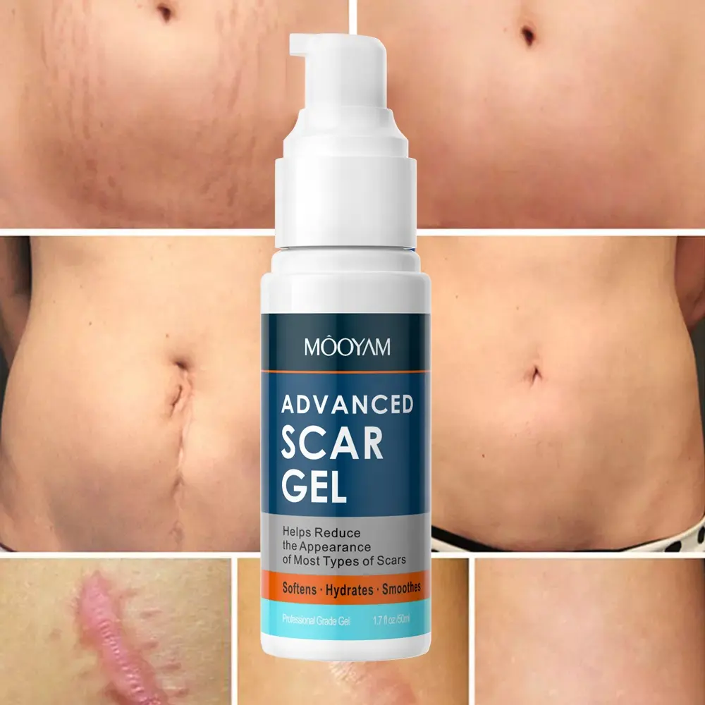 Strong Effective Acne Scar Removal Gel Pimples Stretch Marks Remove Face Gel Tummy Tuck Tightening Advanced Scar Gel