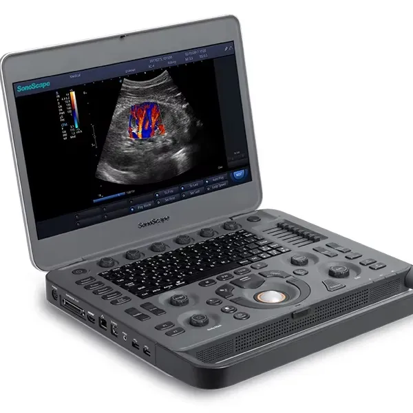 Hot Sale Sonoscape Ultrasound X5v X3V Laptop Portable 4D Color Doppler Ultrasound System with Bluetooth Wireless Connection